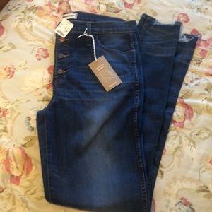 Madewell button up skinny jeans